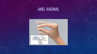 ANEL VAGINAL
 