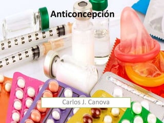 Anticoncepción
Carlos J. Canova
 