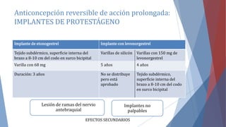 Anticoncepción reversible de acción prolongada:
IMPLANTES DE PROTESTÁGENO
Implante de etonogestrel Implante con levonorgestrel
Tejido subdérmico, superficie interna del
brazo a 8-10 cm del codo en surco bicipital
Varillas de silicón Varillas con 150 mg de
levonorgestrel
Varilla con 68 mg 5 años 4 años
Duración: 3 años No se distribuye
pero está
aprobado
Tejido subdérmico,
superficie interna del
brazo a 8-10 cm del codo
en surco bicipital
EFECTOS SECUNDARIOS
Implantes no
palpables
Lesión de ramas del nervio
antebraquial
 