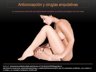 Romero A. Anexectomía profiláctica.[Sede web] [Acceso al 13 de Abril del 2016] Disponible en:
http://www.hvn.es/servicios_asistenciales/ginecologia_y_obstetricia/ficheros/curso2013_gine_03_anexectomia_profilactica._una_cuestion_d
e_modas_o_un_verdadero_fundamento_cientifico.pdf
La menopausia inducida quirúrgicamente complica el estado psicológico de una mujer
 