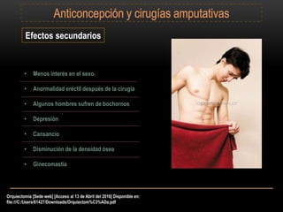 Orquiectomía [Sede web] [Acceso al 13 de Abril del 2016] Disponible en:
file:///C:/Users/61427/Downloads/Orquiectom%C3%ADa.pdf
Efectos secundarios
• Menos interés en el sexo.
• Anormalidad eréctil después de la cirugía
• Algunos hombres sufren de bochornos
• Depresión
• Cansancio
• Disminución de la densidad ósea
• Ginecomastia
 