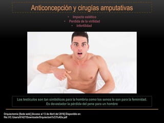 Orquiectomía [Sede web] [Acceso al 13 de Abril del 2016] Disponible en:
file:///C:/Users/61427/Downloads/Orquiectom%C3%ADa.pdf
• Impacto estético
• Perdida de la virilidad
• Infertilidad
Los testículos son tan simbólicos para la hombría como los senos lo son para la feminidad.
Es devastador la pérdida del pene para un hombre
 