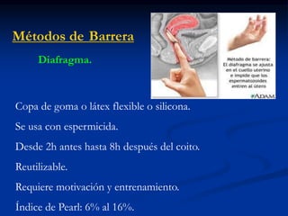 Métodos de Barrera
Diafragma.
Copa de goma o látex flexible o silicona.
Se usa con espermicida.
Desde 2h antes hasta 8h después del coito.
Reutilizable.
Requiere motivación y entrenamiento.
Índice de Pearl: 6% al 16%.
 