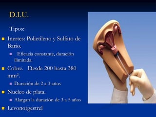 D.I.U.
Tipos:
 Inertes: Polietileno y Sulfato de
Bario.
 Eficacia constante, duración
ilimitada.
 Cobre. Desde 200 hasta 380
mm².
 Duración de 2 a 3 años
 Nucleo de plata.
 Alargan la duración de 3 a 5 años
 Levonorgestrel
 