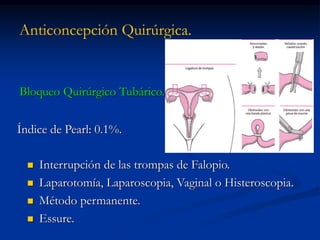 Anticoncepción Quirúrgica.
Bloqueo Quirúrgico Tubárico.
 Interrupción de las trompas de Falopio.
 Laparotomía, Laparoscopia, Vaginal o Histeroscopia.
 Método permanente.
 Essure.
Índice de Pearl: 0.1%.
 