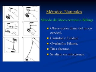 Métodos Naturales
 Observación diaria del moco
cervical.
 Cantidad y Calidad.
 Ovulación: Filante.
 Días alternos.
 Se altera en infecciones.
Método del Moco cervical o Billings
 