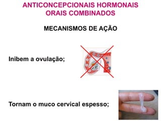 ANTICONCEPCIONAIS HORMONAIS
ORAIS COMBINADOS
Inibem a ovulação;
Tornam o muco cervical espesso;
MECANISMOS DE AÇÃO
 