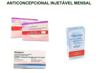 ANTICONCEPCIONAL INJETÁVEL MENSAL
 
