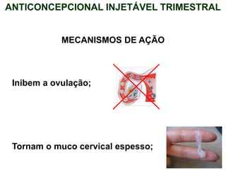 ANTICONCEPCIONAL INJETÁVEL TRIMESTRAL
Inibem a ovulação;
Tornam o muco cervical espesso;
MECANISMOS DE AÇÃO
 