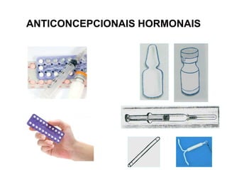 ANTICONCEPCIONAIS HORMONAIS
 