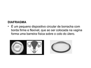 DIAFRAGMA
• É um pequeno dispositivo circular de borracha com
  borda firme e flexível, que ao ser colocada na vagina
  forma uma barreira física sobre o colo do útero.
 