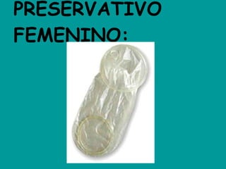 PRESERVATIVO FEMENINO: 