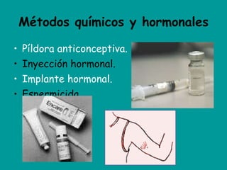 Métodos químicos y hormonales Píldora anticonceptiva. Inyección hormonal. Implante hormonal. Espermicida 