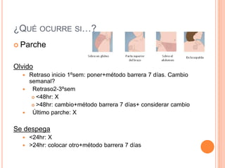 ¿QUÉ OCURRE SI…?
 Parche
Olvido
 Retraso inicio 1ºsem: poner+método barrera 7 días. Cambio
semanal?
 Retraso2-3ºsem
 <48hr: X
 >48hr: cambio+método barrera 7 días+ considerar cambio
 Último parche: X
Se despega
 <24hr: X
 >24hr: colocar otro+método barrera 7 días
 