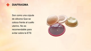 DIAFRAGMA
Son como una cúpula
de silicona Que se
coloca frente al cuello
uterino. No es
recomendable para
evitar sobre la ETS
 