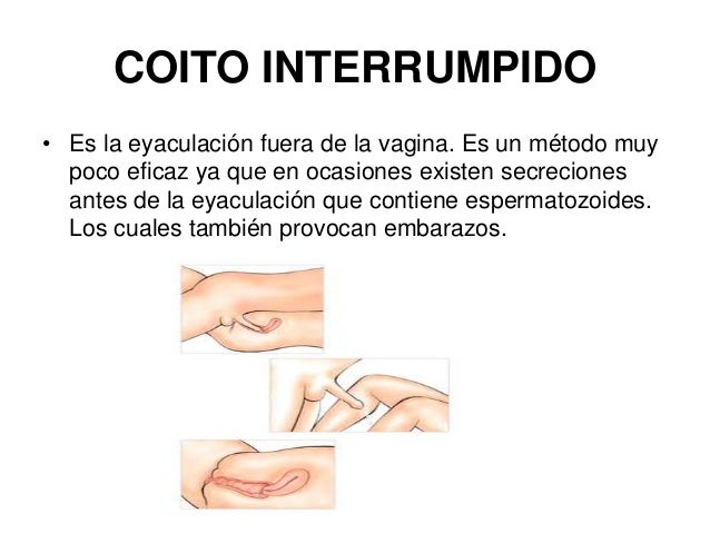 Cuando estás duele mucho tiempo la espalda más abajo de las espátulas
