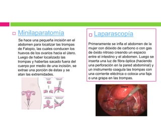    Minilaparatomía                            Laparascopía
    Se hace una pequeña incisión en el
    abdomen para localizar las trompas      Primeramente se infla el abdomen de la
    de Falopio, las cuales conducen los     mujer con dióxido de carbono o con gas
    huevos de los ovarios hacia el útero.   de óxido nitroso creando un espacio
    Luego de haber localizado las           entre el intestino y el abdomen. Luego se
    trompas y haberlas sacado fuera del     inserta una luz de fibra óptica (haciendo
    cuerpo por medio de una incisión, se    una perforación en la pared abdominal) y
    extrae una porción de éstas y se        un instrumento coagula las trompas con
    atan las extremidades.                  una corriente eléctrica o coloca una faja
                                            o una grapa en las trompas.
 