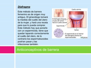 Diafragma
Este método de barrera
femenino es de origen muy
antiguo. El ginecólogo tomará
la medida del cuello del útero
de la mujer, y hará una receta
para que lo pueda comprar.
Este método hay que ponerlo
con un espermicida, tiene que
quedar tapando correctamente
el cuello del útero, de lo
contrario los espermatozoides
podrían pasar y las
infecciones también.

Anticonceptivos de barrera
 