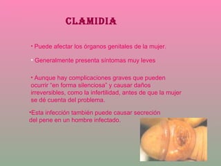 CLAMIDIA Puede afectar los órganos genitales de la mujer.  Generalmente presenta síntomas muy leves Aunque hay complicaciones graves que pueden ocurrir “en forma silenciosa” y causar daños irreversibles, como la infertilidad, antes de que la mujer se dé cuenta del problema.  Esta infección también puede causar secreción del pene en un hombre infectado. 