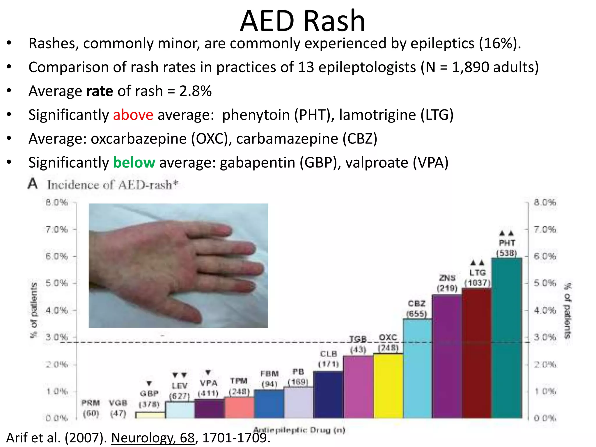 AED Rash
•   Rashes, commonly minor, are commonly experienced by epileptics (16%).
•   Comparison of rash rates in practices of 13 epileptologists (N = 1,890 adults)
•   Average rate of rash = 2.8%
•   Significantly above average: phenytoin (PHT), lamotrigine (LTG)
•   Average: oxcarbazepine (OXC), carbamazepine (CBZ)
•   Significantly below average: gabapentin (GBP), valproate (VPA)




Arif et al. (2007). Neurology, 68, 1701-1709.
 