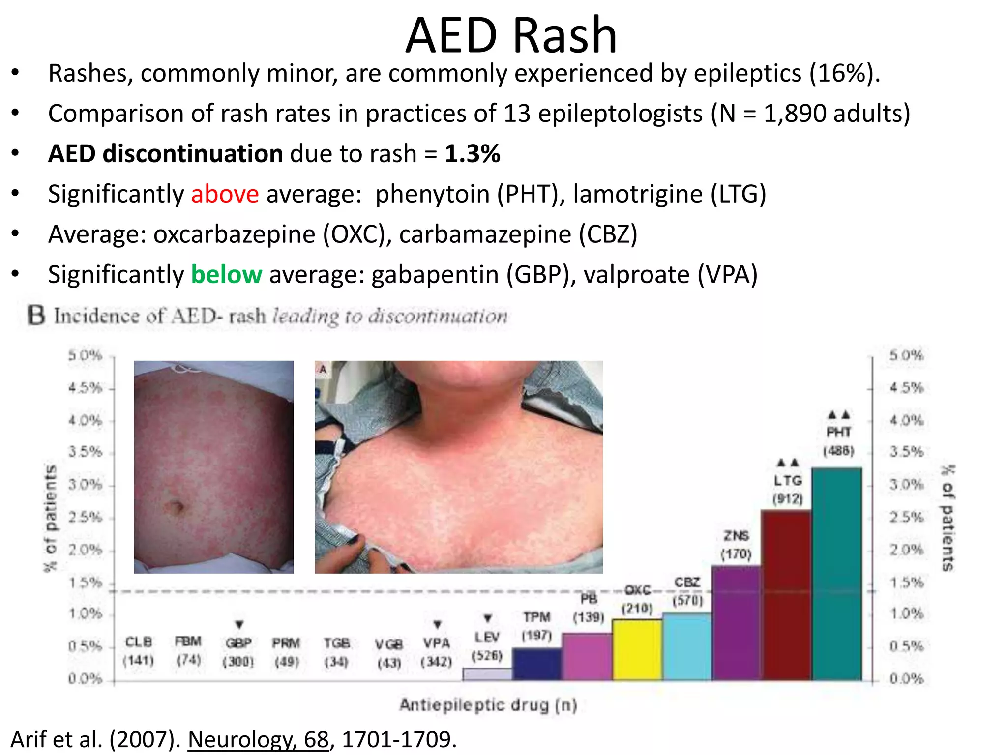 AED Rash
•   Rashes, commonly minor, are commonly experienced by epileptics (16%).
•   Comparison of rash rates in practices of 13 epileptologists (N = 1,890 adults)
•   AED discontinuation due to rash = 1.3%
•   Significantly above average: phenytoin (PHT), lamotrigine (LTG)
•   Average: oxcarbazepine (OXC), carbamazepine (CBZ)
•   Significantly below average: gabapentin (GBP), valproate (VPA)




Arif et al. (2007). Neurology, 68, 1701-1709.
 