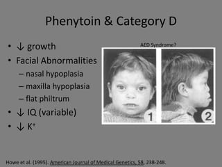 Phenytoin & Category D
• ↓ growth                                                AED Syndrome?


• Facial Abnormalities
     – nasal hypoplasia
     – maxilla hypoplasia
     – flat philtrum
• ↓ IQ (variable)
• ↓ K+


Howe et al. (1995). American Journal of Medical Genetics, 58, 238-248.
 