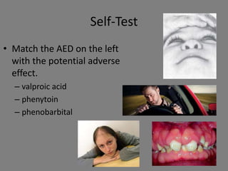 Self-Test
• Match the AED on the left
  with the potential adverse
  effect.
  – valproic acid
  – phenytoin
  – phenobarbital
 
