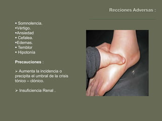  Somnolencia.
Vértigo.
Ansiedad
 Cefalea.
Edemas.
 Temblor
 Hipotonía

Precauciones :

 Aumenta la incidencia o
precipita el umbral de la crisis
tónico – clónico.

 Insuficiencia Renal .
 