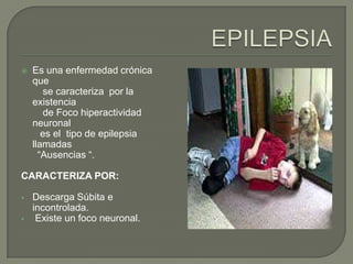    Es una enfermedad crónica
    que
       se caracteriza por la
    existencia
       de Foco hiperactividad
    neuronal
       es el tipo de epilepsia
    llamadas
      “Ausencias “.

CARACTERIZA POR:

   Descarga Súbita e
    incontrolada.
    Existe un foco neuronal.
 