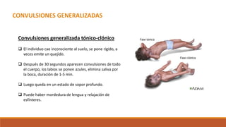 Anticonvulsivantes.pptx