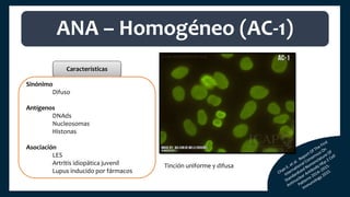 Características
Sinónimo
Difuso
Antígenos
DNAds
Nucleosomas
Histonas
Asociación
LES
Artritis idiopática juvenil
Lupus inducido por fármacos
ANA – Homogéneo (AC-1)
Tinción uniforme y difusa
 