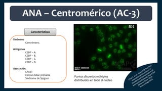 Sinónimo
Centrómero.
Antígenos
CEBP – A.
CEBP – B.
CEBP – C.
CEBP – D.
Asociación.
CREST
Cirrosis biliar primaria
Síndrome de Sjogren
ANA – Centromérico (AC-3)
Características
Puntos discretos múltiples
distribuidos en todo el núcleo
 