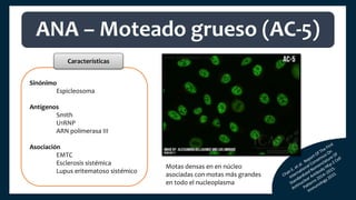 Sinónimo
Espicleosoma
Antígenos
Smith
U1RNP
ARN polimerasa III
Asociación
EMTC
Esclerosis sistémica
Lupus eritematoso sistémico
ANA – Moteado grueso (AC-5)
Características
Motas densas en en núcleo
asociadas con motas más grandes
en todo el nucleoplasma
 