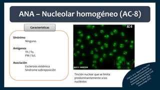 Sinónimo
Ninguno.
Antígenos
Th / To.
PM / Scl.
Asociación
Esclerosis sistémica
Síndrome sobreposición
ANA – Nucleolar homogéneo (AC-8)
Características
Tinción nuclear que se limita
predominantemente a los
nucléolos
 