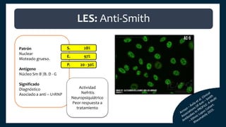 Patrón
Nuclear
Moteado grueso.
Antígeno
Núcleo Sm B´/B. D - G
Significado
Diagnóstico
Asociado a anti – U1RNP
NÚCLEO.
S. 28%
E. 97%
P. 20 - 30%
Actividad
Nefritis
Neuropsiquiátrico
Peor respuesta a
tratamiento
LES: Anti-Smith
 