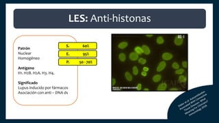 Patrón
Nuclear
Homogéneo
Antígeno
H1. H2B. H2A. H3. H4.
Significado
Lupus inducido por fármacos
Asociación con anti – DNA ds
S. 60%
E. 95%
P. 50 - 70%
LES: Anti-histonas
 
