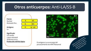 Patrón
Nuclear
Moteado fino
Antígeno
La
Significado
LES tardío
Lupus neonatal
Síndrome sicca
Protección nefritis lúpica
S. 14%
E. 82%
P. 10 - 15%
Otros anticuerpos: Anti-LA/SS-B
El antígeno La se encarga del
procesamiento de ARN ribosomal
 