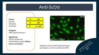 Patrón
Nuclear
Moteado
Nucleolar
Antígeno
DNA topoisomerasa I
Significado
Fibrosis pulmonar
Enfermedad cutánea difusa
Mayor mortalidad
S. 43%
E. 90%
P. 22 - 40%
Anti-Scl70
Dirigido contra la ADN topoisomerasa I
que separa y une las cadenas de ADN
 