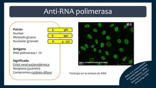 Patrón
Nuclear
Moteado grueso
Nucleolar granular
Antígeno
RNA polimerasa I - III
Significado.
Crisis renal esclerodérmica
Neoplasia (pulmón)
Compromiso cutáneo difuso
S. 38%
E. 94%
P. 4 - 23%
Anti-RNA polimerasa
Participa en la síntesis de ARN
 