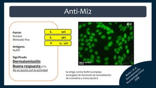 Patrón
Nuclear
Moteado fino
Antígeno.
NuRD
Significado
Dermatomiositis
Buena respuesta a tx.
No se asocia con la actividad
S. 50%
E. 96%
P. 15 - 20%
Anti-Mi2
Se dirige contra NuRD (complejo
encargado de funciones de remodelación
de cromatina y transcripción)
 