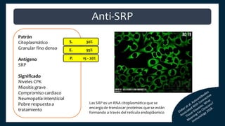 Patrón
Citoplasmático
Granular fino denso
Antígeno
SRP
Significado
Niveles CPK
Miositis grave
Compromiso cardiaco
Neumopatía intersticial
Pobre respuesta a
tratamiento
S. 30%
E. 95%
P. 15 - 20%
Anti-SRP
Las SRP es un RNA citoplasmática que se
encarga de translocar proteínas que se están
formando a través del retículo endoplásmico
 