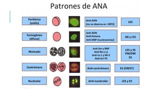 Comprehensive Overview of Antinuclear Antibodies (ANA) in Autoimmune ...