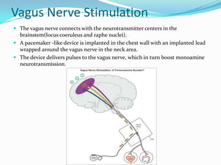 Vagus Nerve Stimulation
 The vagus nerve connects with the neurotransmitter centers in the
  brainstem(locus coeruleus and raphe nuclei).
 A pacemaker -like device is implanted in the chest wall with an implanted lead
  wrapped around the vagus nerve in the neck area.
 The device delivers pulses to the vagus nerve, which in turn boost monoamine
  neurotransmission.
 