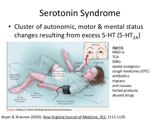 Ssri serotonin syndrome
