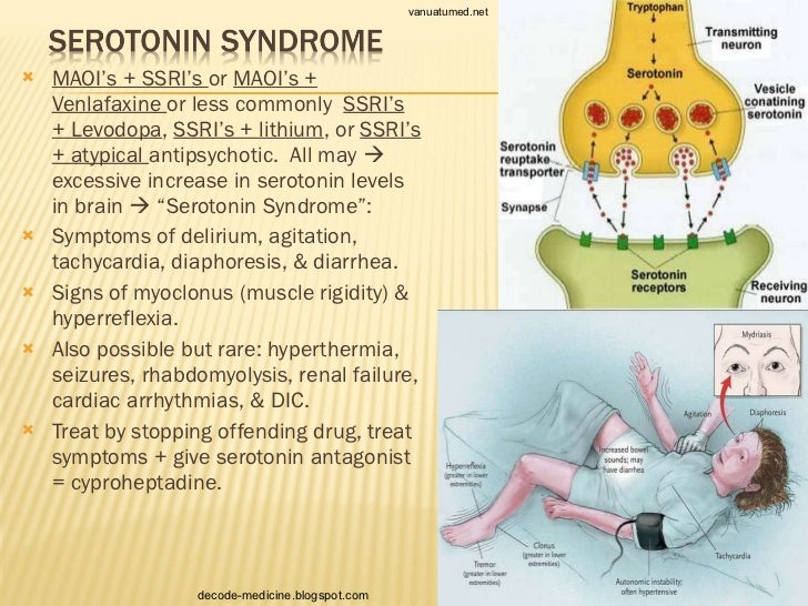 how to cure ssri discontinuation syndrome