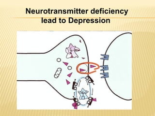 Neurotransmitter deficiency
lead to Depression
 