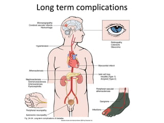 Long term complications
 