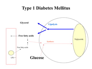 Triglyceride
LPL
Type 1 Diabetes Mellitus
Lipolysis
Glycerol
Free fatty acids
Free fatty acids
Glucose
Synthesis
 