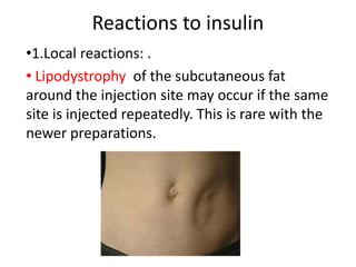 Reactions to insulin
•1.Local reactions: .
• Lipodystrophy of the subcutaneous fat
around the injection site may occur if the same
site is injected repeatedly. This is rare with the
newer preparations.
 