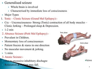  Generalised seizure
 Whole brain is involved
 Characterised by immediate loss of consciousness
 Major Types
1. Tonic – Clonic Seizure (Grand Mal Epilepsy):-
 Cry – Unconsciousness- Strong (Tonic) contraction of all body muscles –
Clonic Jerking – Prolonged sleep & Depression.
 1-2 min
2. Absence Seizure (Petit Mal Epilepsy):-
 Prevalant in Children.
 Momemtary loss of consciousnees
 Patient freezes & stares in one direction
 No muscular movement & jerking.
 ½ mins
3. Atonic Seizure:-
 Due to excessive inhabitory dischagre
 Relaxation & Patient may fall.
4
 